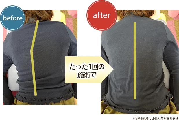 施術前後での変化その1